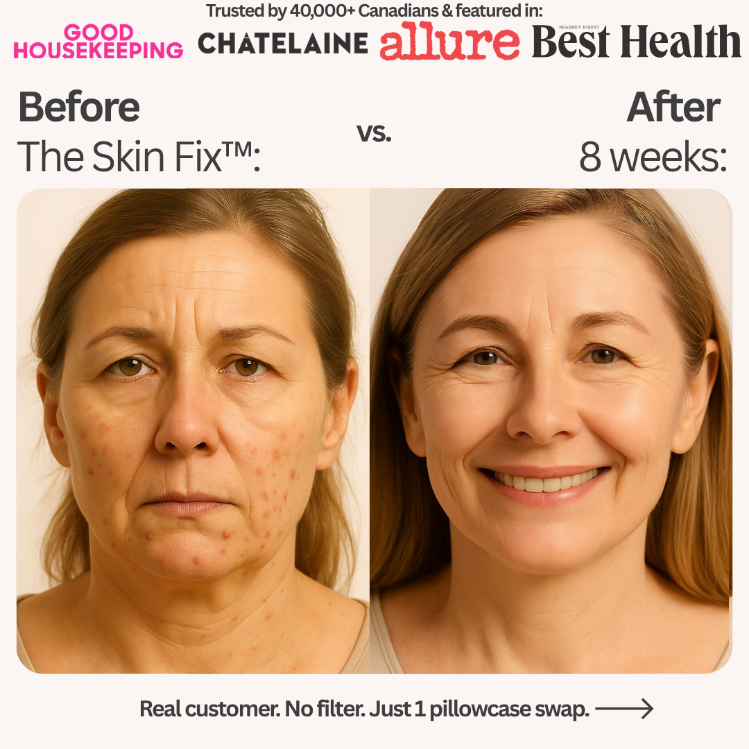 The Skin Fix™